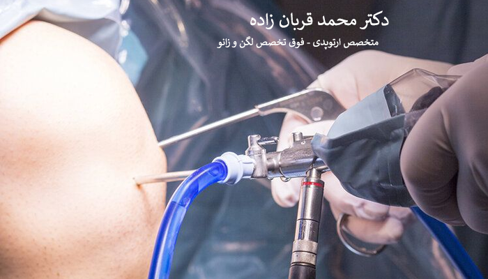 آرتروسکوپی یا جراحی زانو؟