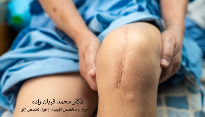عکس جای بخیه عمل زانو