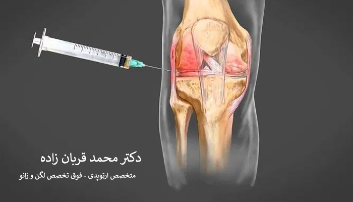 پی آر پی چیست؟