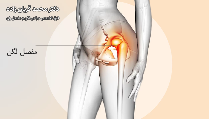 شایع ترین مشکلات مفصل لگن