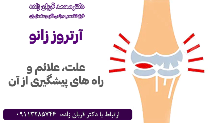 آرتروز زانو چیست و چه علائمی دارد؟