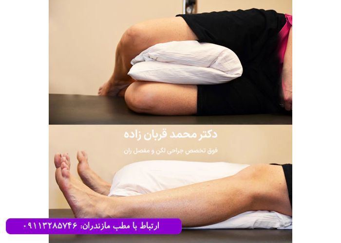 استراحت بعد از آرتروسکوپی لگن