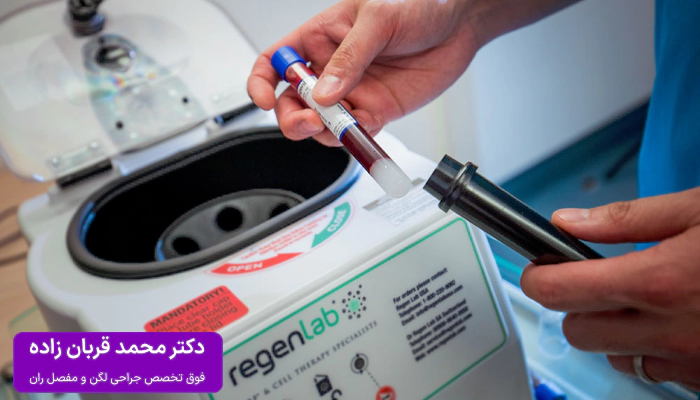 پی آر پی لگن چگونه انجام میشود؟