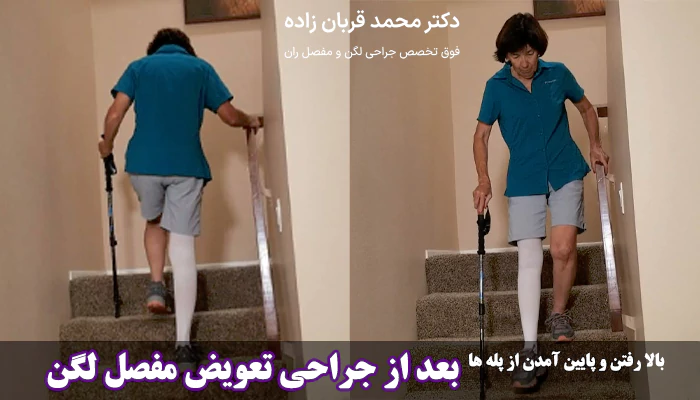 بالا رفتن و پایین آمدت از پله ها بعد از تعویض مفصل لگن