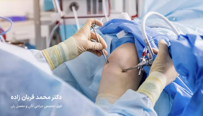 آرتروسکوپی زانو در مازندران چگونه انجام میشود؟