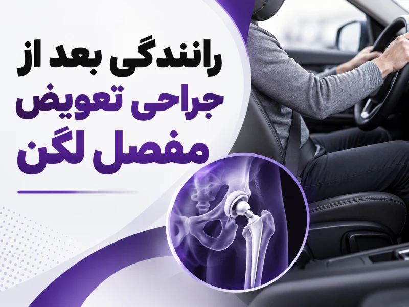 رانندگی بعد از تعویض مفصل لگن
